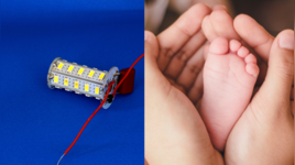Ahmedabad 9-Month-Old Boy Swallows LED Bulb from Toy Phone Removed After 14 Days Ahmedabad 9-Month-Old Boy Swallows LED Bulb from Toy Phone Removed After 14 Days
